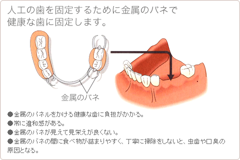 lH̎Œ肷邽߂ɋ̃olŌNȎɌŒ肵܂B